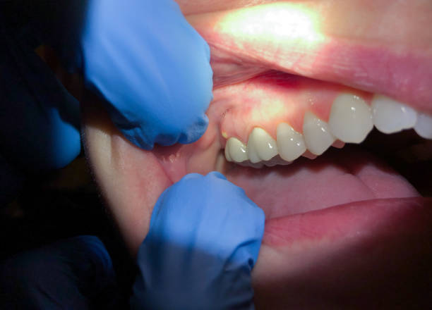 Best Emergency Treatment for Jaw Pain or Injury in Ozark, MO